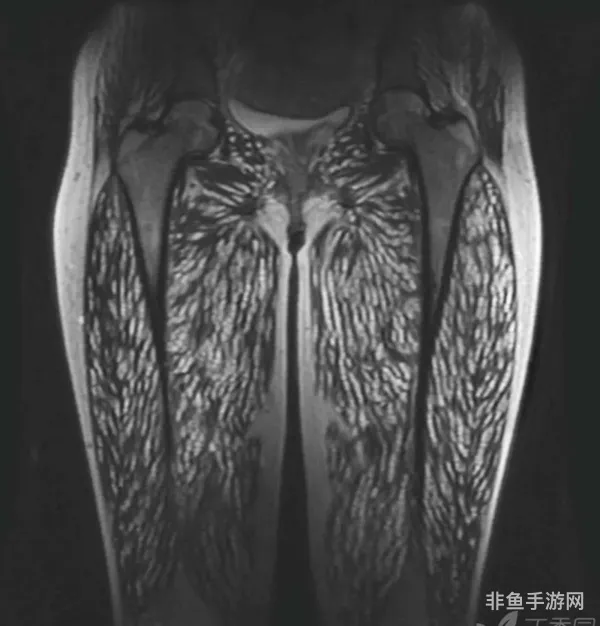 潜藏者的腿甲(血腥腿甲何处寻)